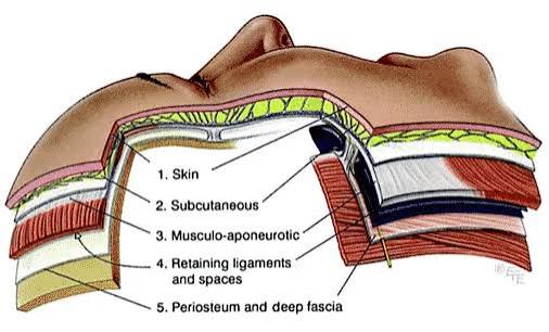 SMAS three-plane composite facelift SMAS three-plane composite lifting surgery for jawline and jowls